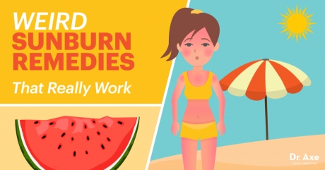 Speaking is easy: Sunburn